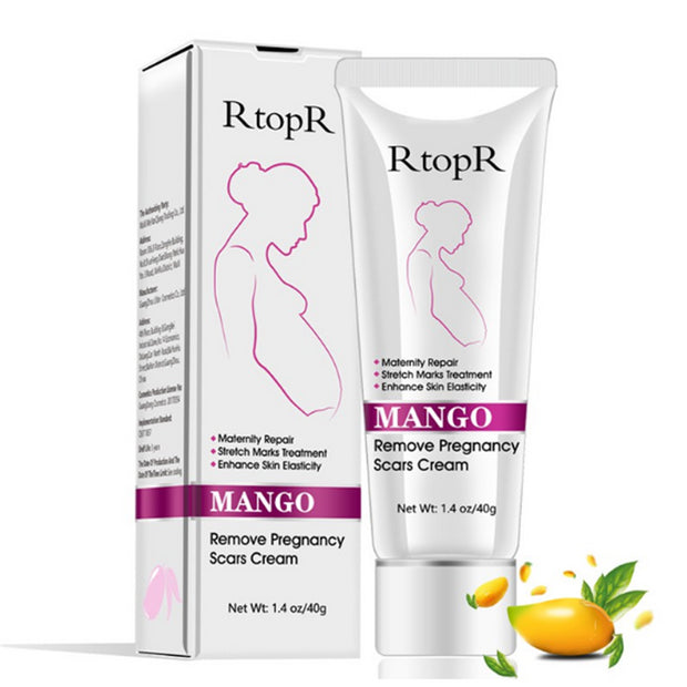 Natural Mild Non-irritating Mango Remove Stretch Mark Cream For Pregnancy Repair Scar Slack Line Abdomen Stretch Marks Cream